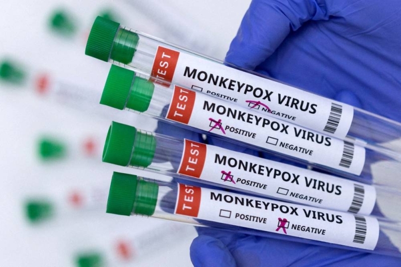 Singapore confirms case of monkeypox, first in Southeast Asia Singapore confirms case of monkeypox, first in Southeast Asia